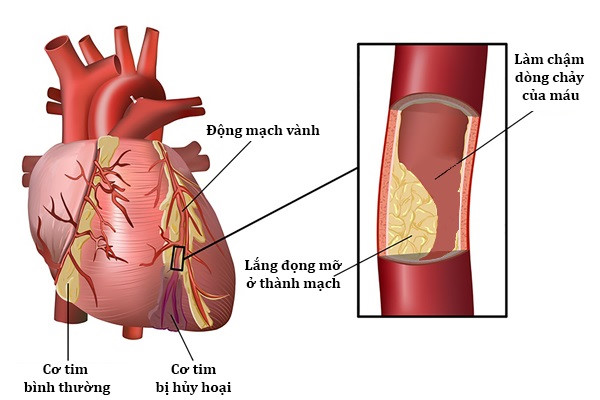 Benh tieu duong va nhung bien chung nguy hiem hinh anh 1